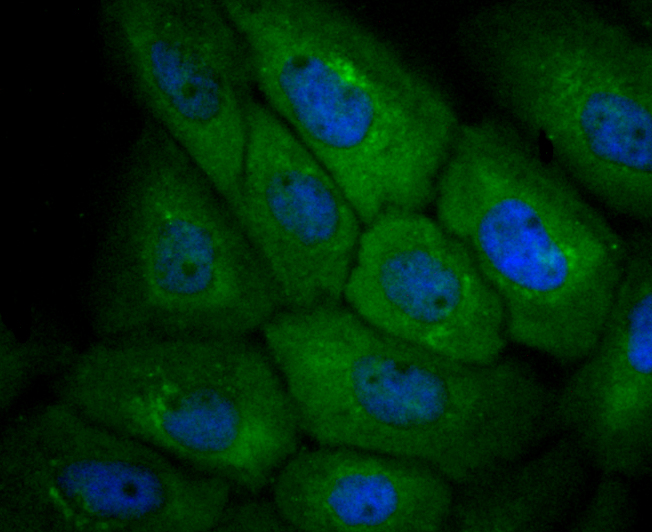 CXCR3 Rabbit mAb