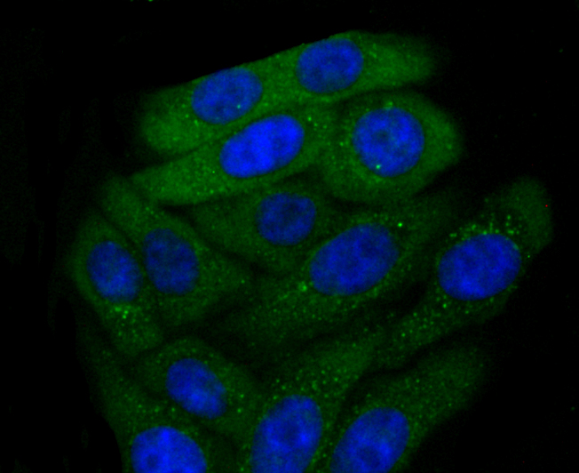 CXCR3 Rabbit mAb