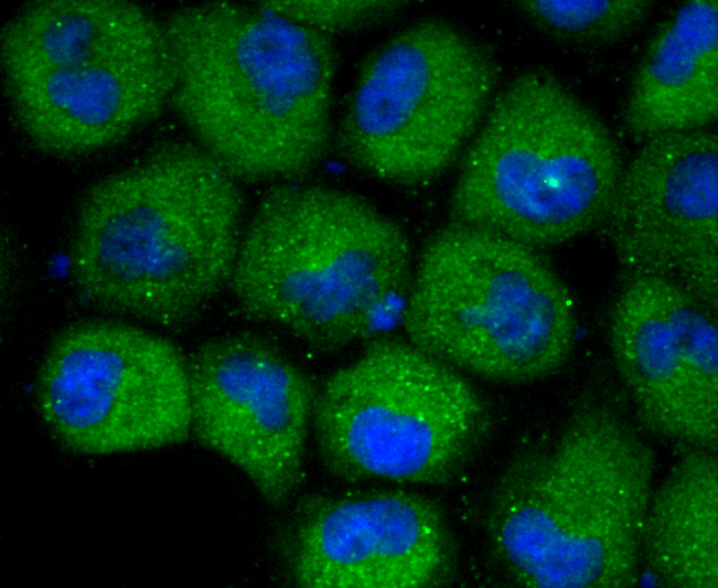 CXCR3 Rabbit mAb