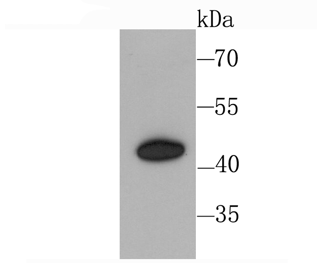 CXCR3 Rabbit mAb