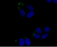 JAK3 Rabbit mAb