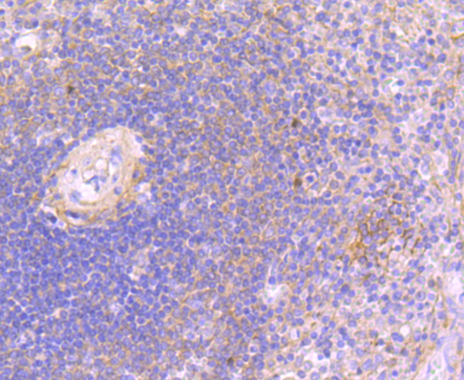 JAK3 Rabbit mAb