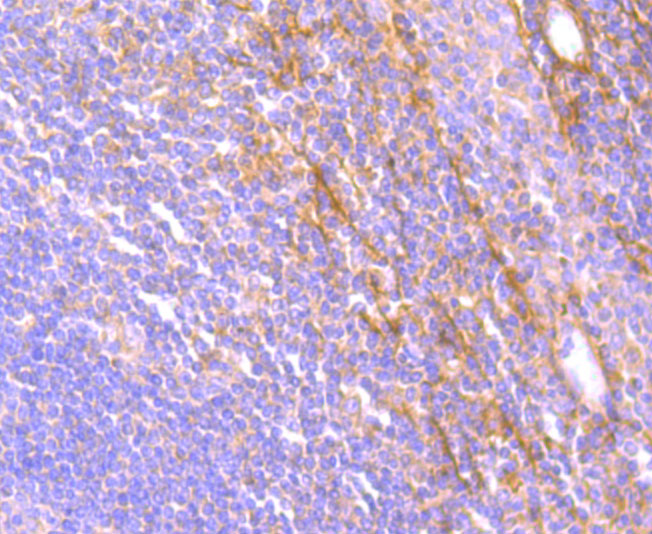 JAK3 Rabbit mAb