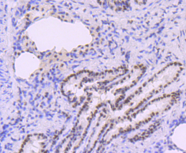 DNA Polymerase beta Rabbit mAb