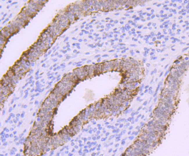 DNA Polymerase beta Rabbit mAb