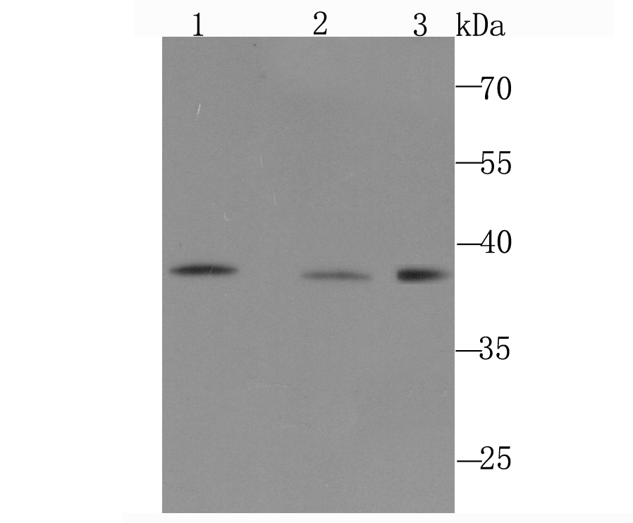 DNA Polymerase beta Rabbit mAb