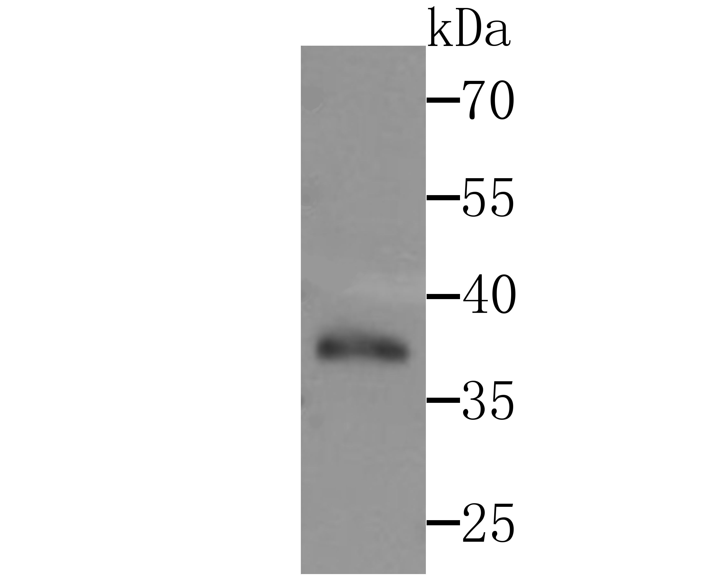 DNA Polymerase beta Rabbit mAb