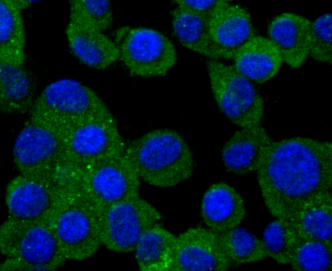 PMP22 Rabbit mAb