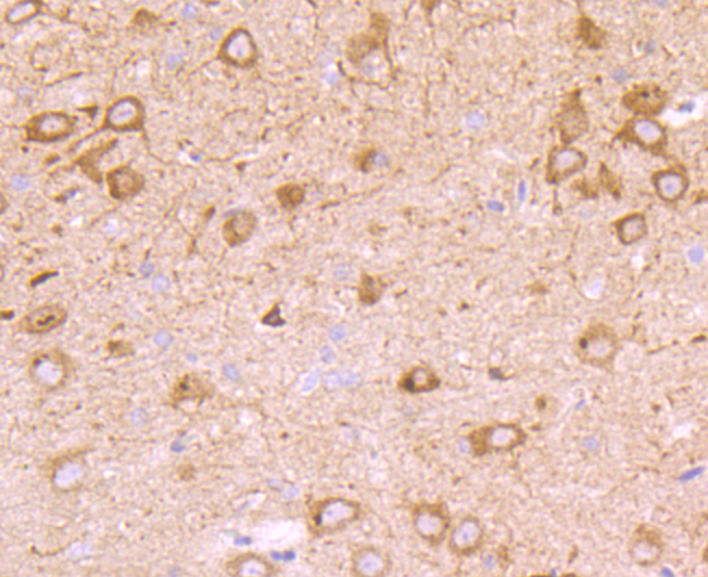 PMP22 Rabbit mAb