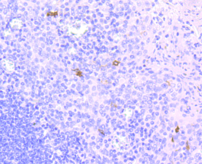 CD1a Rabbit mAb