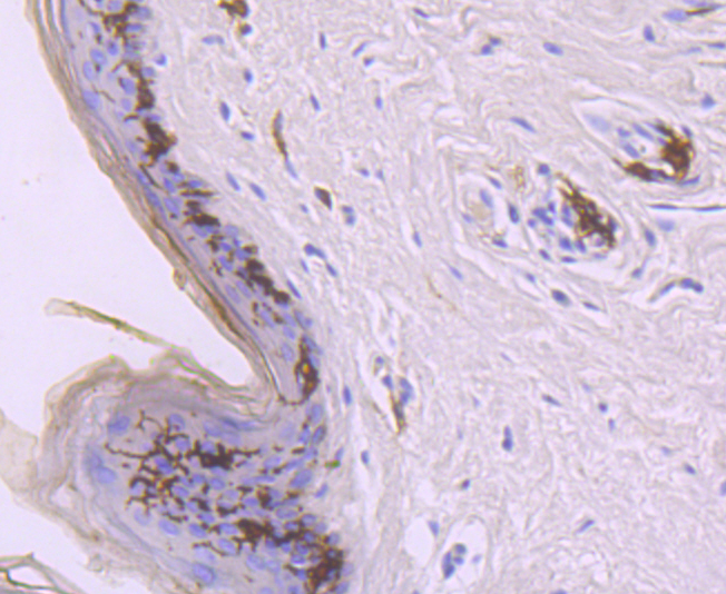 CD1a Rabbit mAb