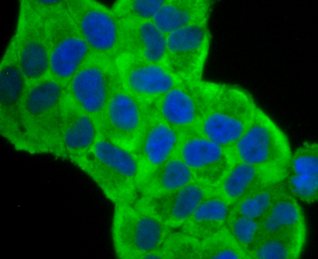 Fascin Rabbit mAb