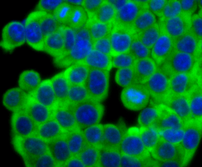 Fascin Rabbit mAb