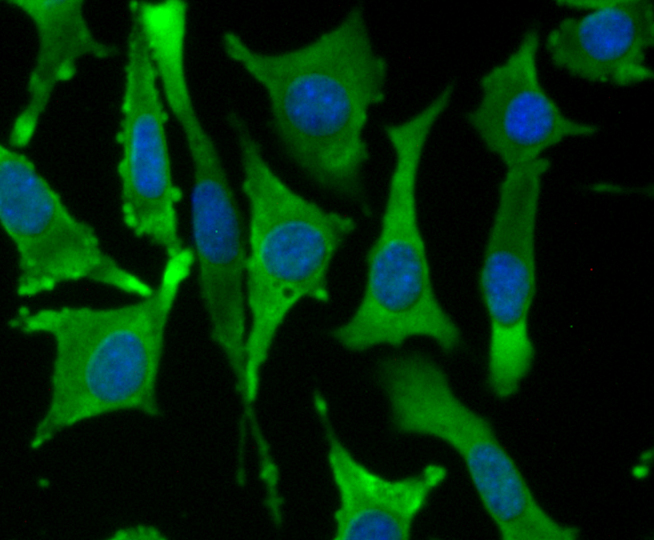 Fascin Rabbit mAb