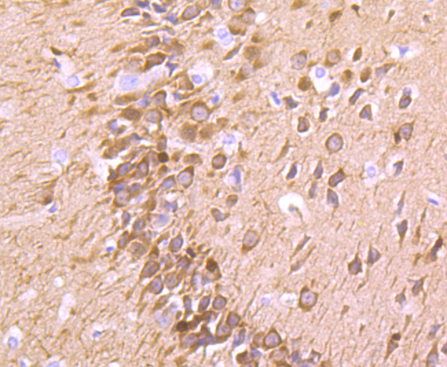 Fascin Rabbit mAb