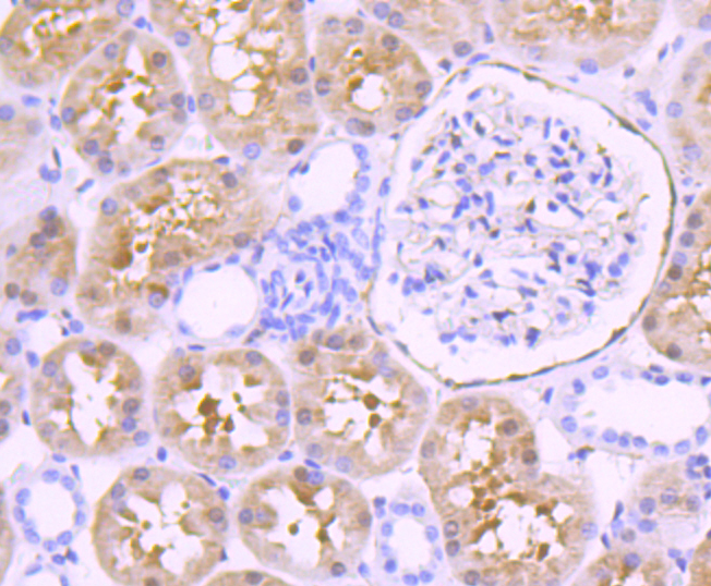 Fascin Rabbit mAb