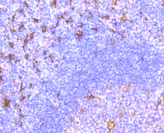 Fascin Rabbit mAb