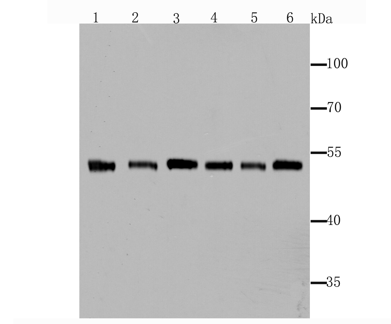 Fascin Rabbit mAb