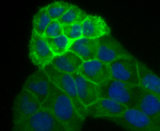 Placental alkaline phosphatase Rabbit mAb