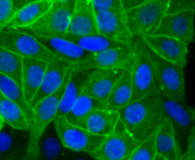 Placental alkaline phosphatase Rabbit mAb