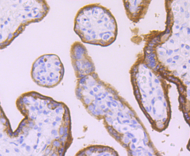 Placental alkaline phosphatase Rabbit mAb