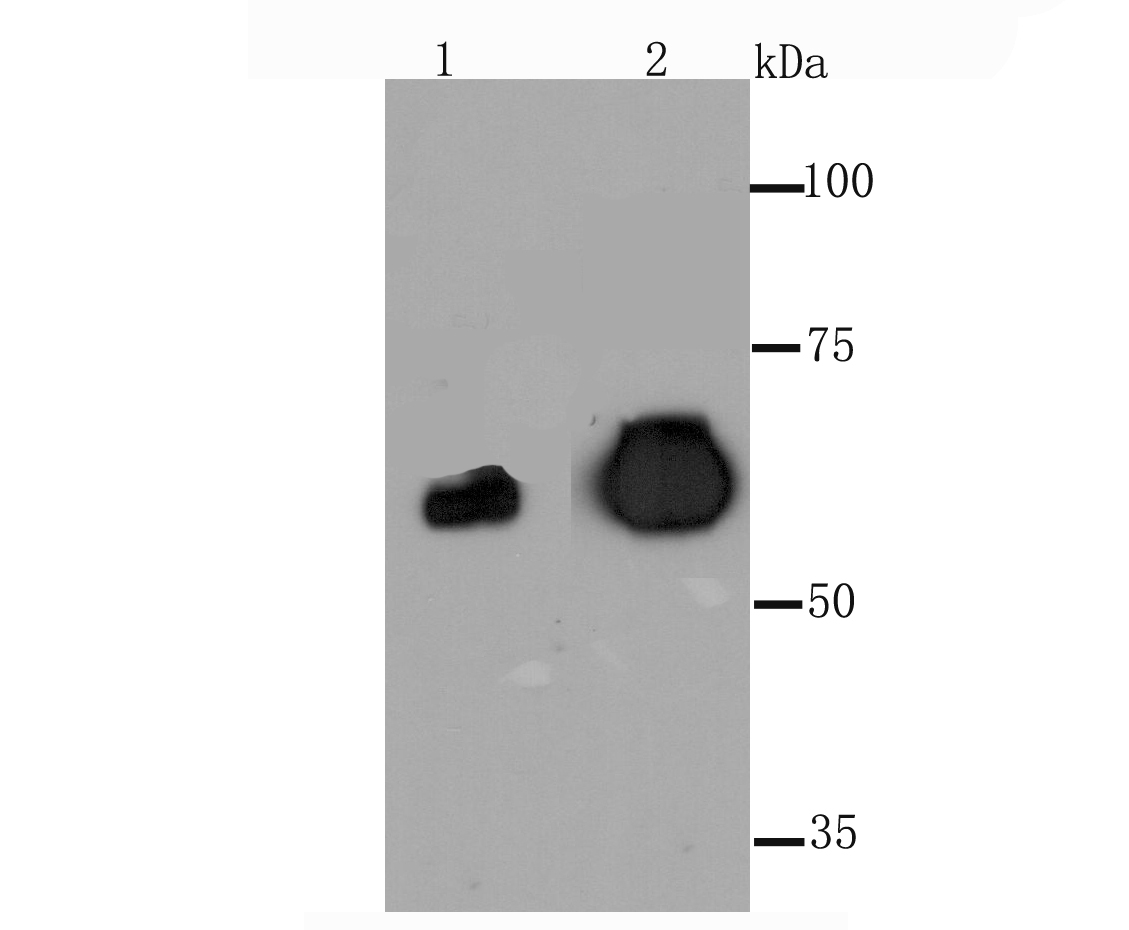 Placental alkaline phosphatase Rabbit mAb