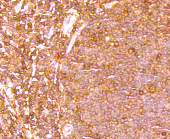 ETS1 Rabbit mAb