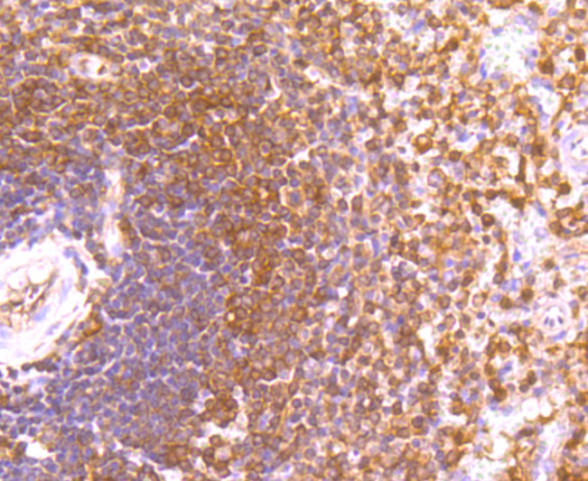 ETS1 Rabbit mAb