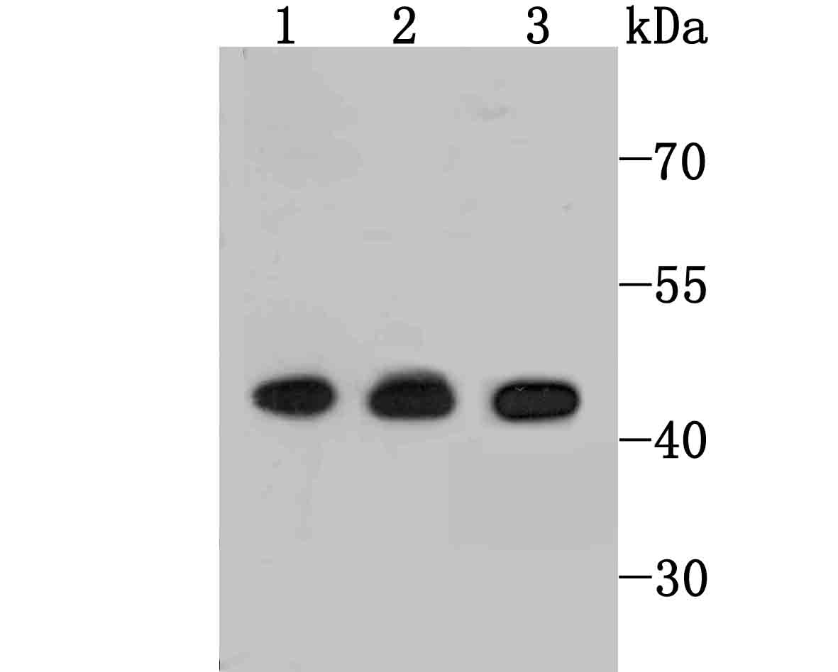 ETS1 Rabbit mAb