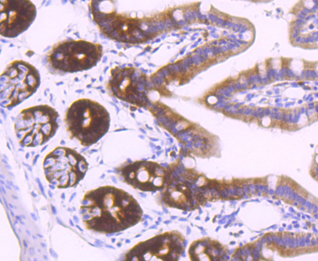 Thymidylate Synthase Rabbit mAb