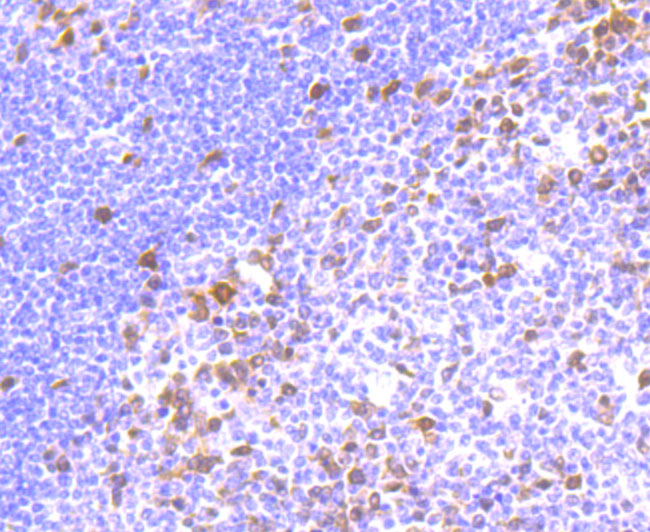 Thymidylate Synthase Rabbit mAb