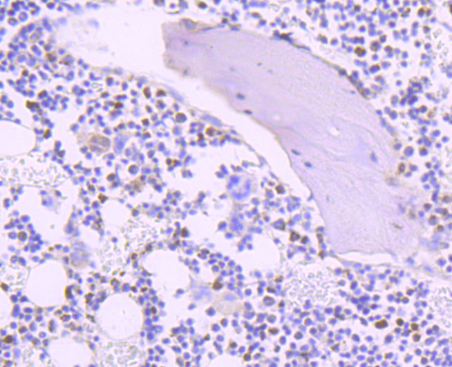 Thymidylate Synthase Rabbit mAb