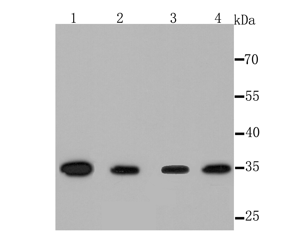 Thymidylate Synthase Rabbit mAb