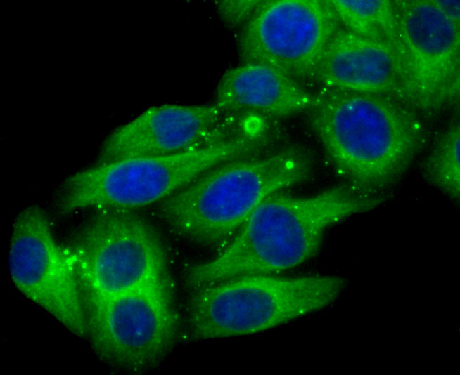 Cytochrome P450 2D6 Rabbit mAb