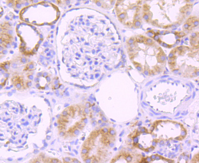 Cytochrome P450 2D6 Rabbit mAb