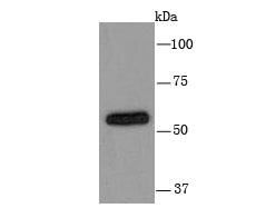 Cytochrome P450 2D6 Rabbit mAb