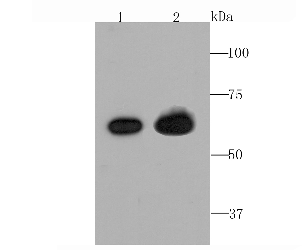 TGFBI Rabbit mAb