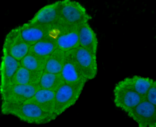 Protein C Rabbit mAb