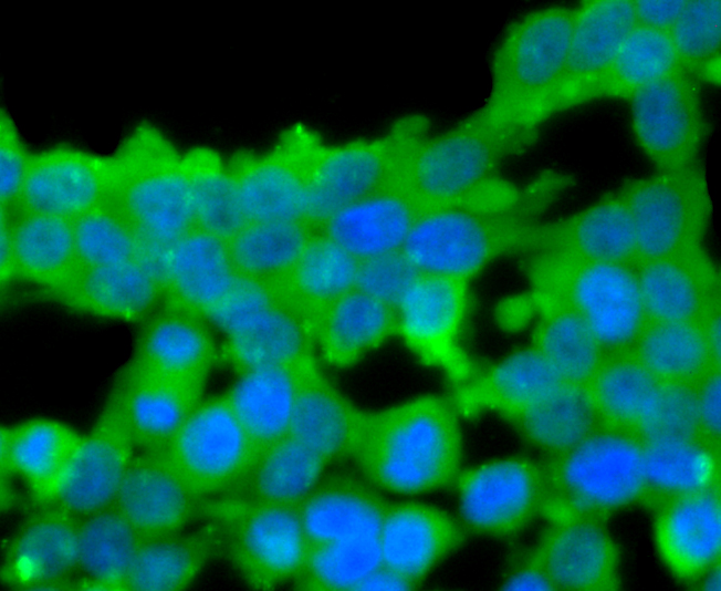 Protein C Rabbit mAb