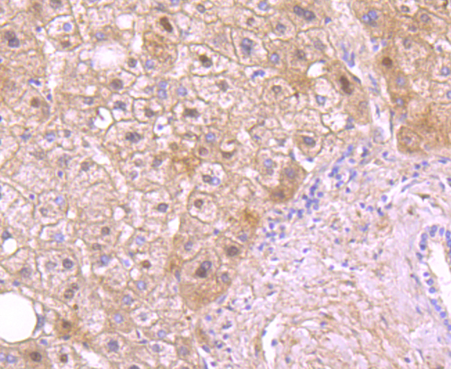 Protein C Rabbit mAb