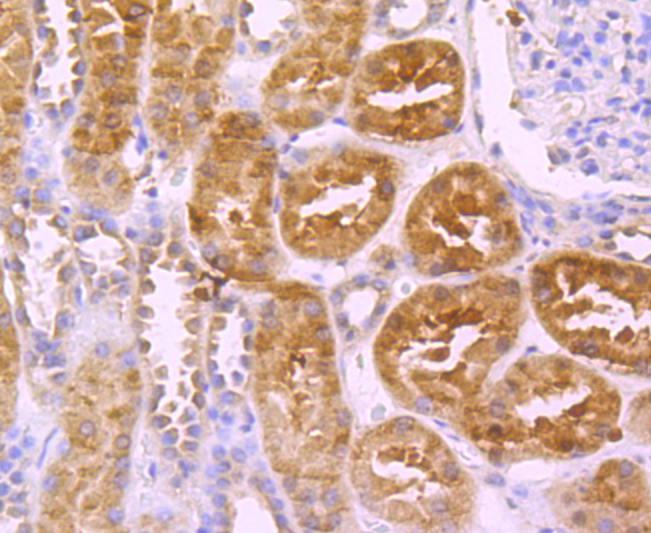 Protein C Rabbit mAb