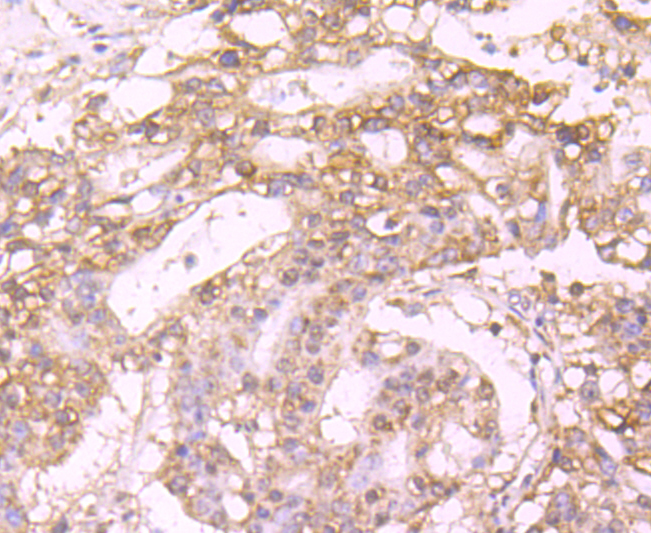 Protein C Rabbit mAb