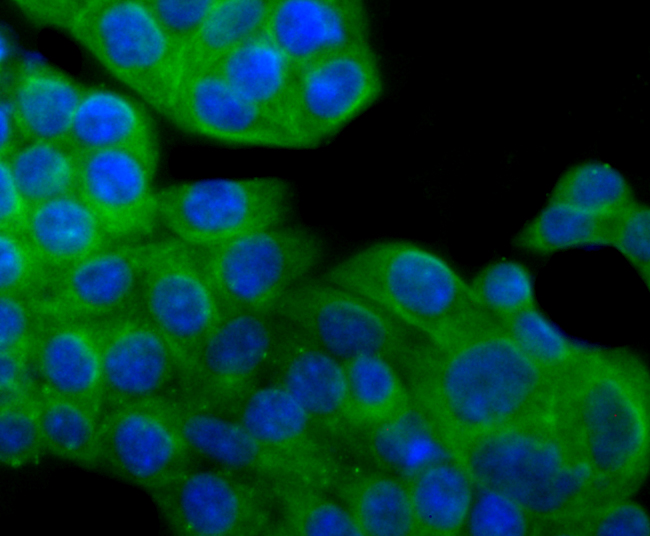 alpha Tubulin 4A Rabbit mAb