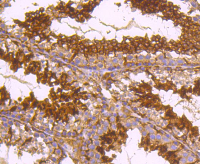 alpha Tubulin 4A Rabbit mAb