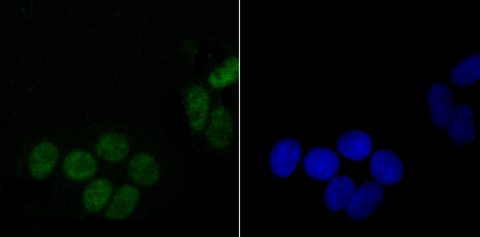 DDX5 Rabbit mAb