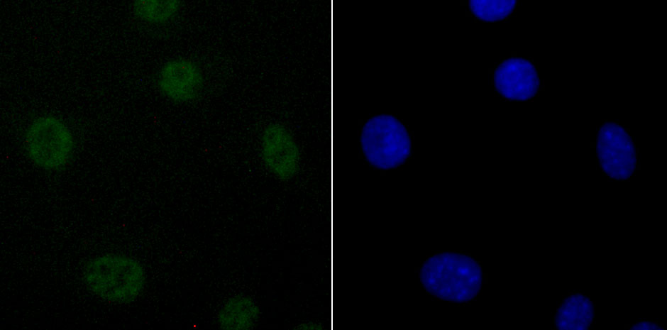 DDX5 Rabbit mAb