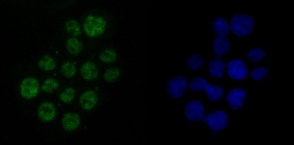 DDX5 Rabbit mAb