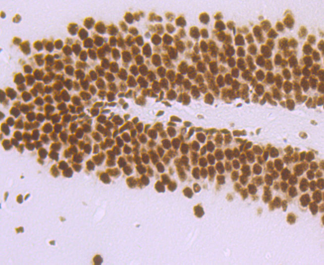 DDX5 Rabbit mAb