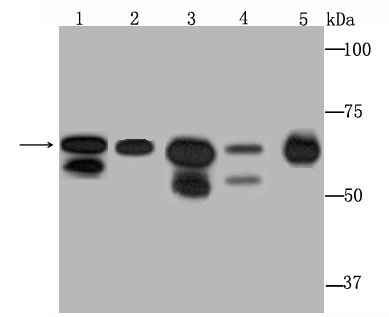 DDX5 Rabbit mAb