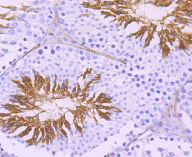 ACE Rabbit mAb